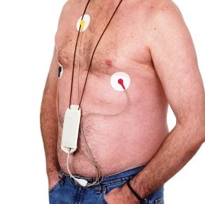 EKG