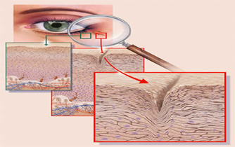 svájci anti aging szeizmikus hiba retinol krém dm