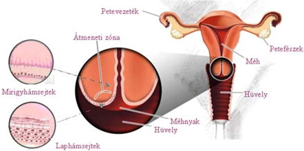 humán papilloma vírus és méhnyakrák