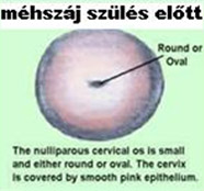 Méhszáj mikroszkópos (kolposzkópos) vizsgálata