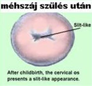 Méhszáj mikroszkópos (kolposzkópos) vizsgálata