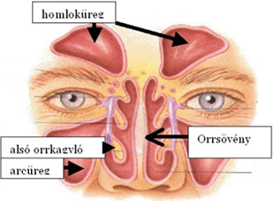 Orrsövény